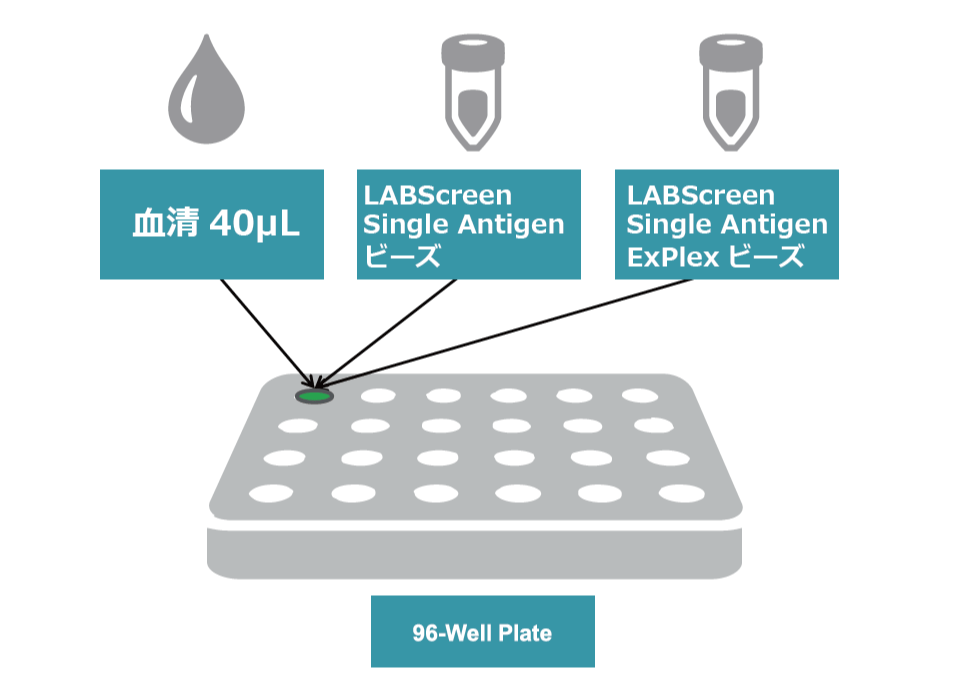 LABScreen-Single Antigen-ExPlex.png