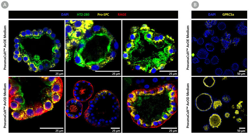 Av-organoid-fig5.jpg