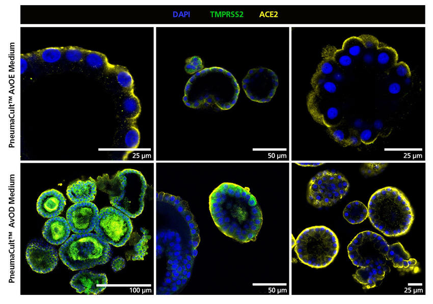 Av-organoid-fig6.jpg