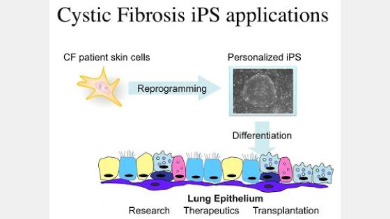 MakingLungCellsfromPluripotentStemCellsDiseaseModelingandFutureTherapies.jpg