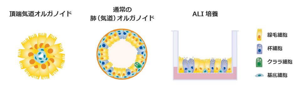 PneumaCult-AOAO-fig1.jpg