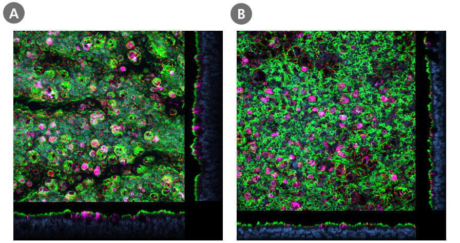 PneumaCult-pressrelease-fig-1.jpg