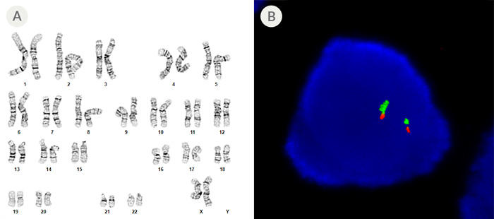 ST-200-0511-fig3.jpg