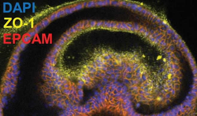 liver_organoid_ms1.jpg