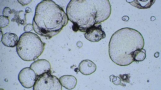 liver_organoid_screen.jpg