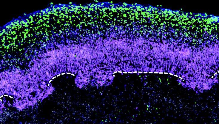 neural_organoid_slice.jpg