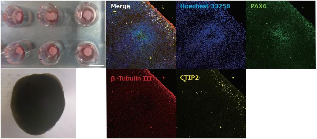 organoid_suzuki.jpg